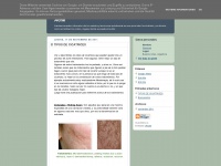 tratamientosparacicatrices.blogspot.com Thumbnail