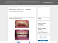 Dentaljaumenin.blogspot.com