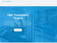Hair-transplant-tijuana.com