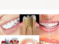 Dental-angelandres.com