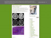 Neuroloblog.blogspot.com