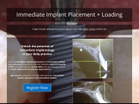 immediateimplant.courses Thumbnail