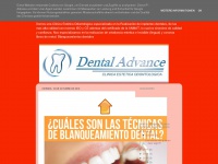 dental-advance.blogspot.com Thumbnail