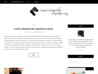 microinjerto-capilar.es