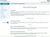 Neuroimagen.es
